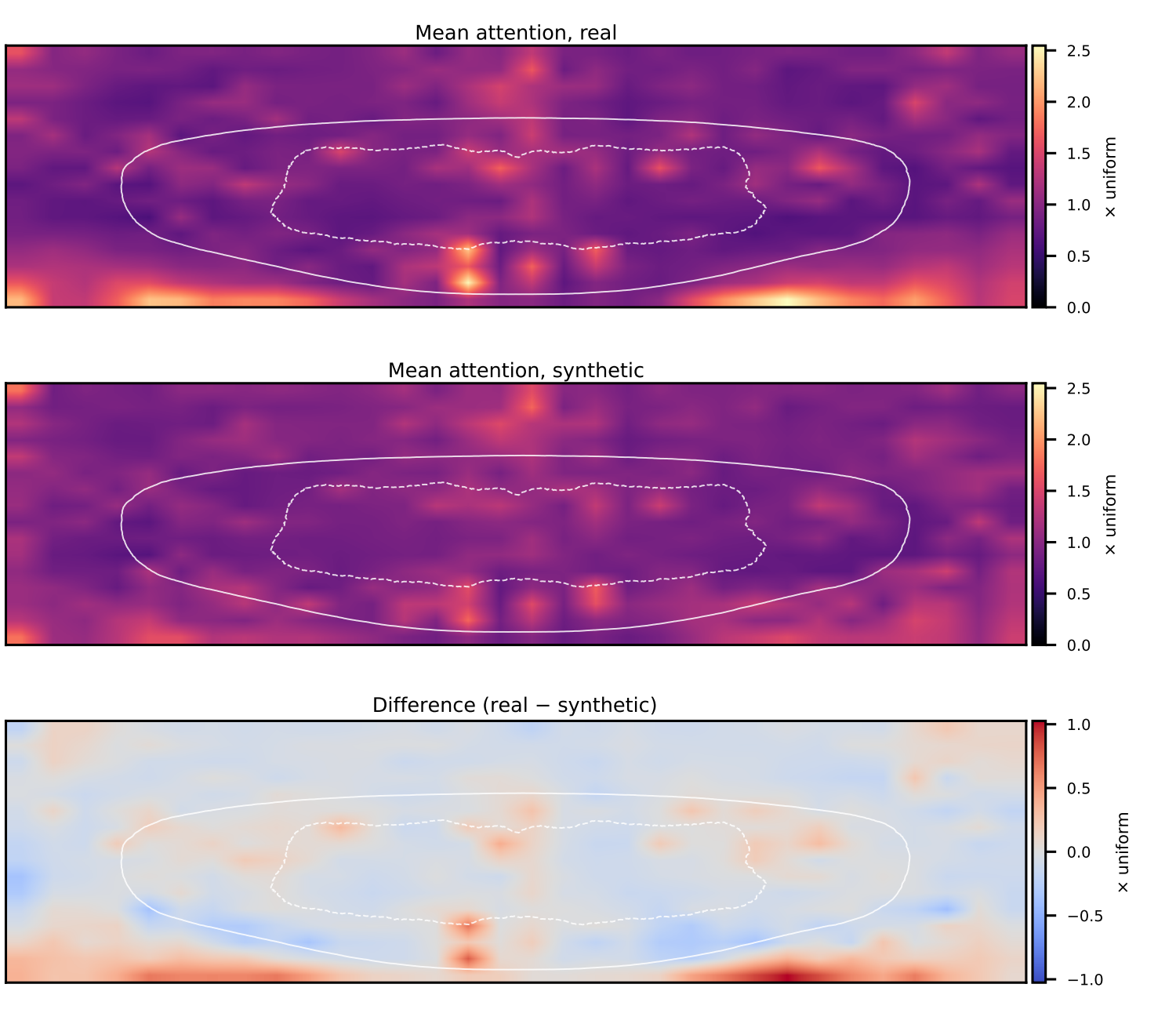 Mean attention maps over all held-out real and synthetic radiographs, and their difference