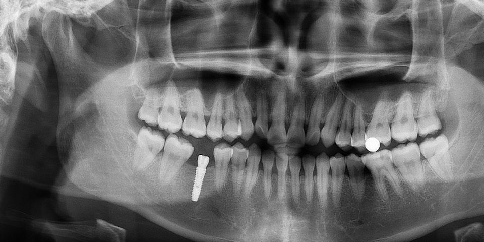 A dental panoramic radiograph, real or synthetic